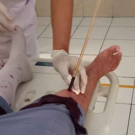 Ini korban siswi SMU Negeri 1 Tual yang terkena panah wayer pada Kejadian tawuran pelajar, Selasa 30 Mei 2023